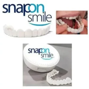Snap-On Smile. - 2.